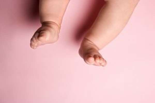 Рекурвация коленных суставов у детей